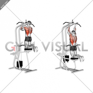 Lever Assisted Chin-Up