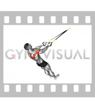 Suspender Reverse Fly (male)