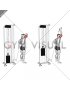 Cable Overhead Single Arm Triceps Extension (rope attachment)