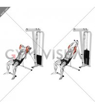 Cable Rope Incline Tricep Extension
