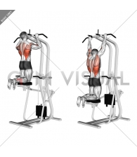 Assisted Pull-up